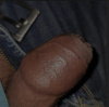 bttmed